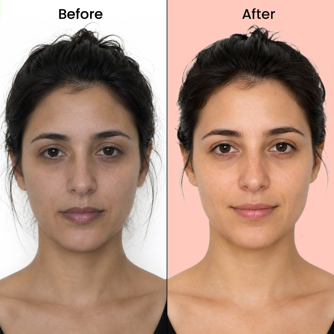 BRIGHTNING GLOW KIT
