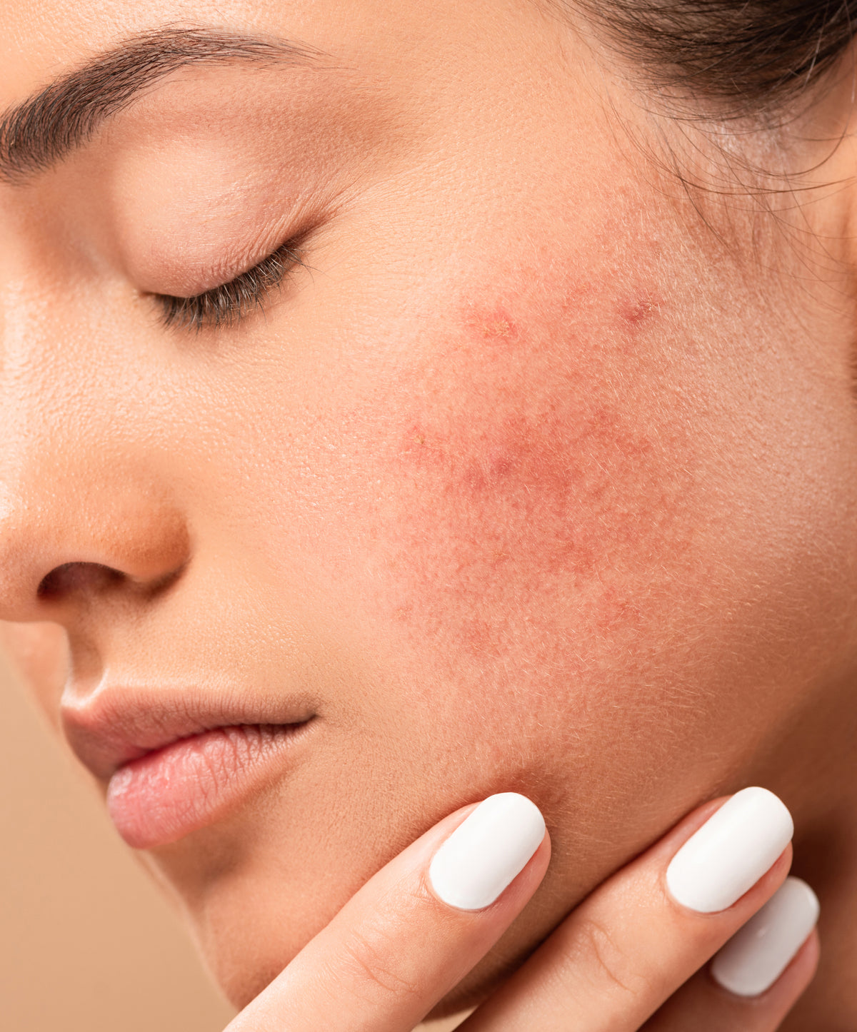 PIGMENTATION